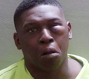 man with swollen eye