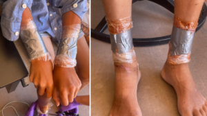 Evidence released depicts the severity of the abuse.