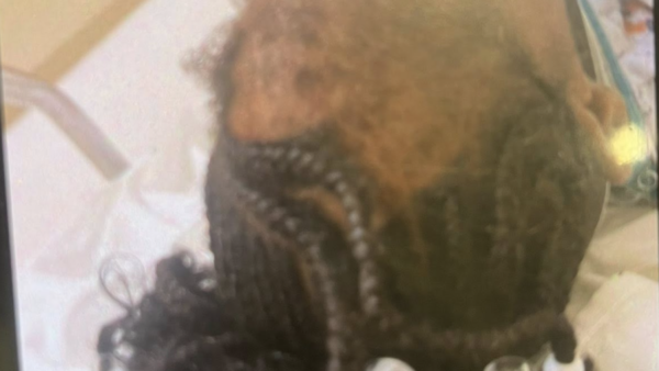 photo of injured child
