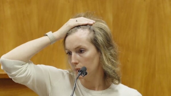 Arielle Konig shows scar on head